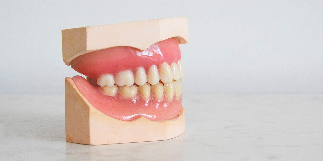 muestra de prótesis dental