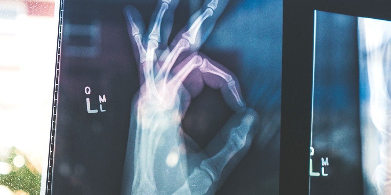 radiografía de mano