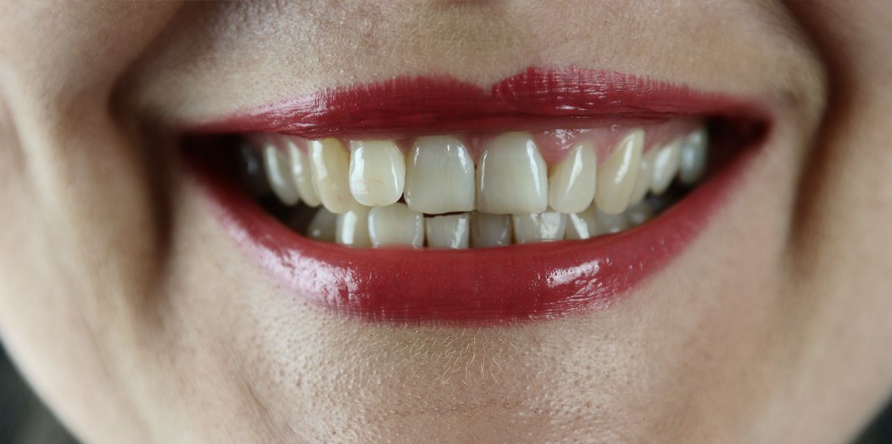 dientes en sonrisa dientes en sonrisa